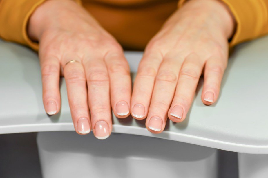 Red, Swollen, or Painful Nail Folds